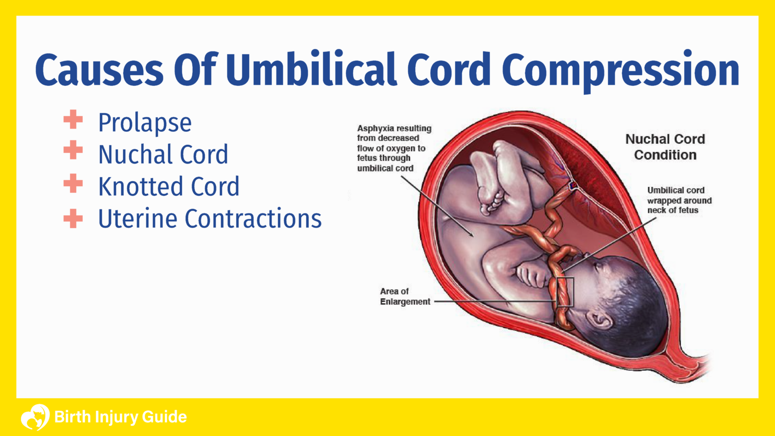 Umbilical Cord Compression And Your Baby S Health Bir - vrogue.co