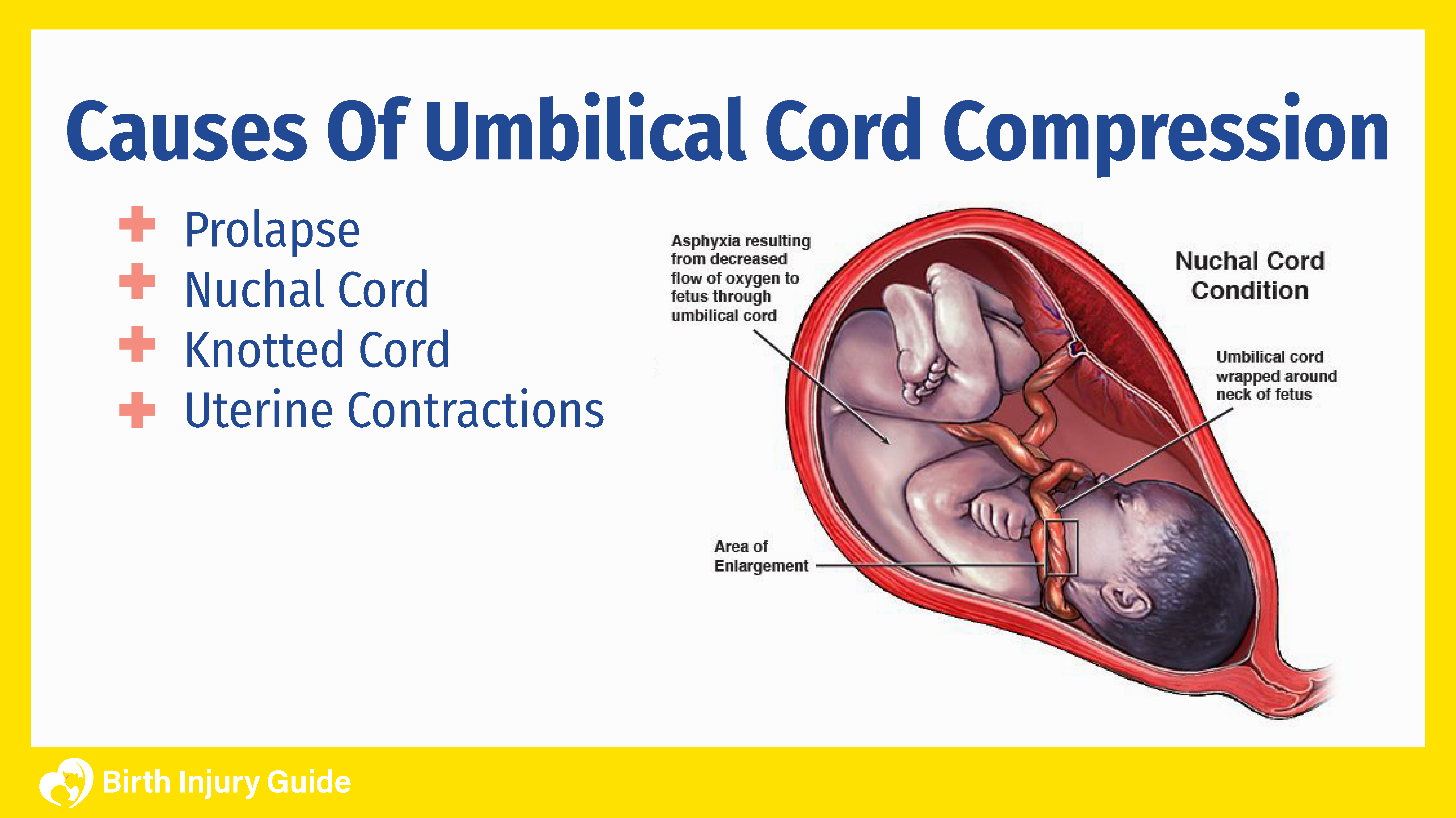 What Are the Signs of Umbilical Cord Compression?