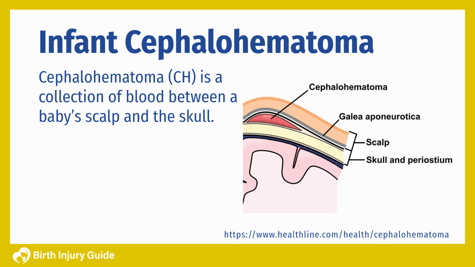 Infant Cephalohematoma, Causes, Treatment and Prevention