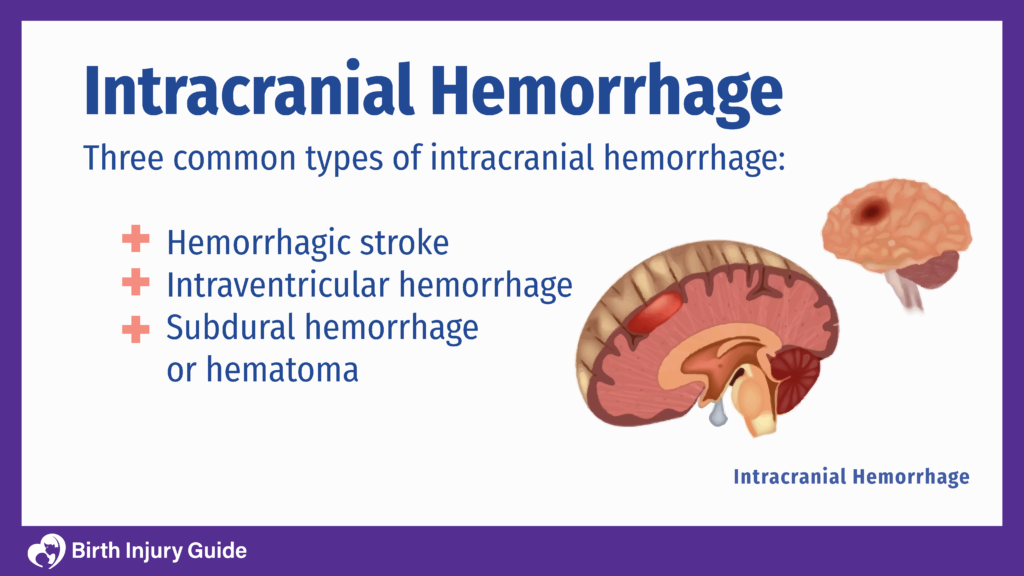 Intracranial Hemorrhage in Babies | Birth Injury Guide