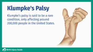 Klumpke’s Palsy | Birth Injury Guide