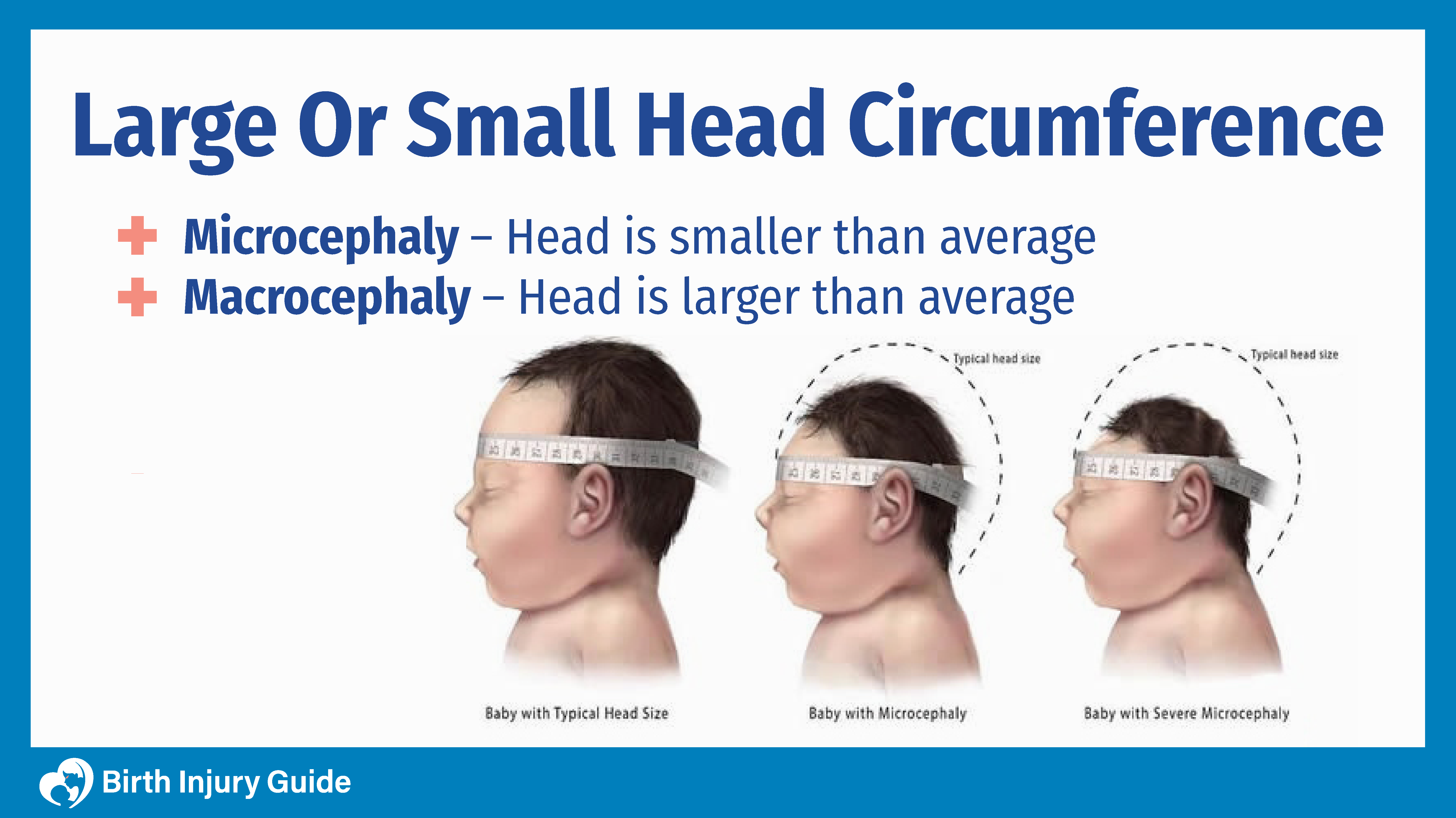 Large or Small Head Injury Circumference Birth Guide 