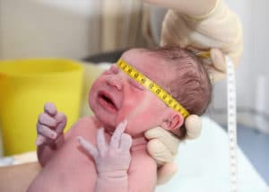 Caput Succedaneum: Causes, Treatment And More - Birth Injury Guide