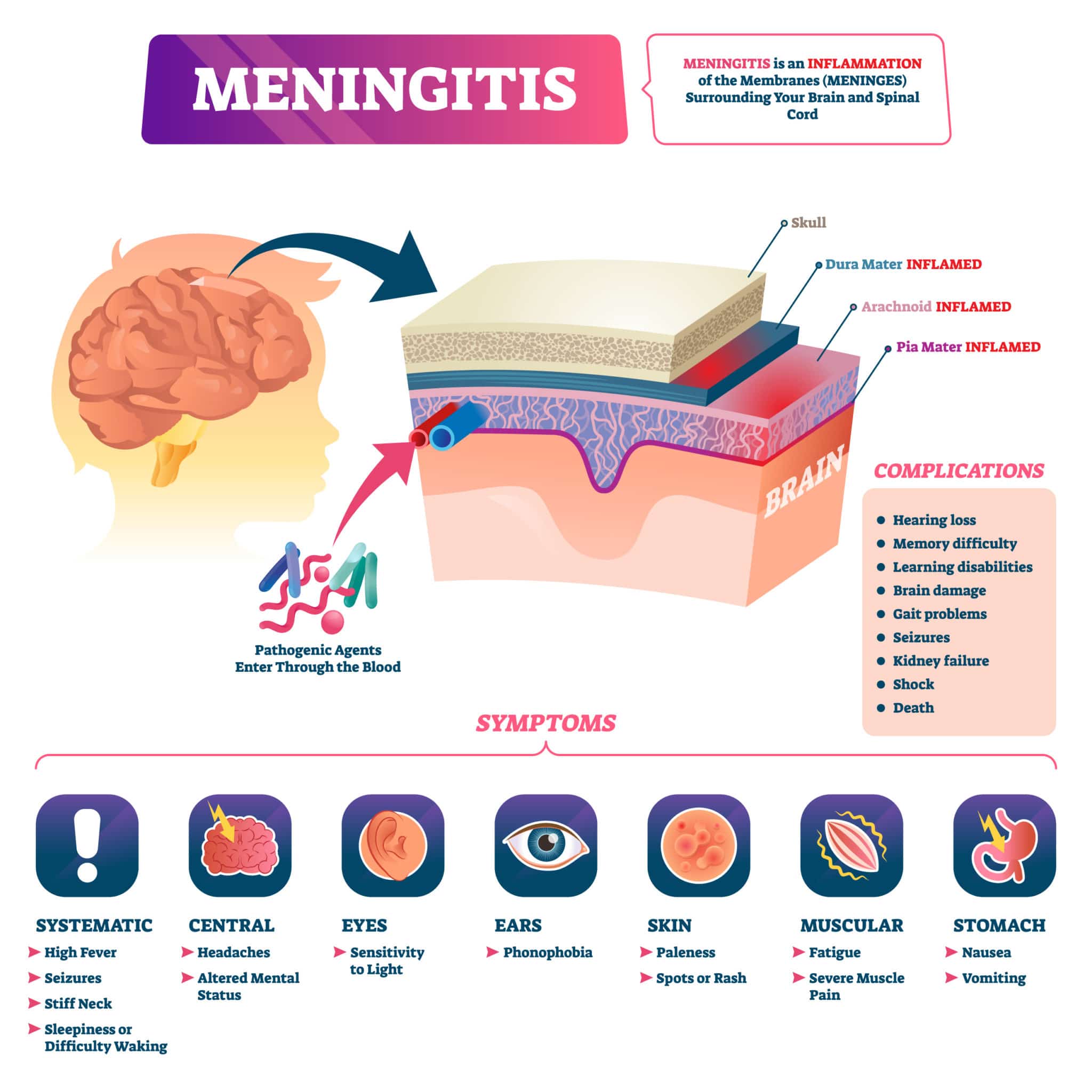 Meningitis in newborns: Long term effects, survival rate, and more