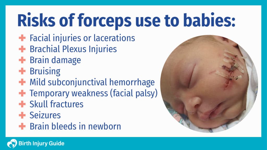 Why Are Forceps Linked to Birth Injuries? Birth Injury Guide