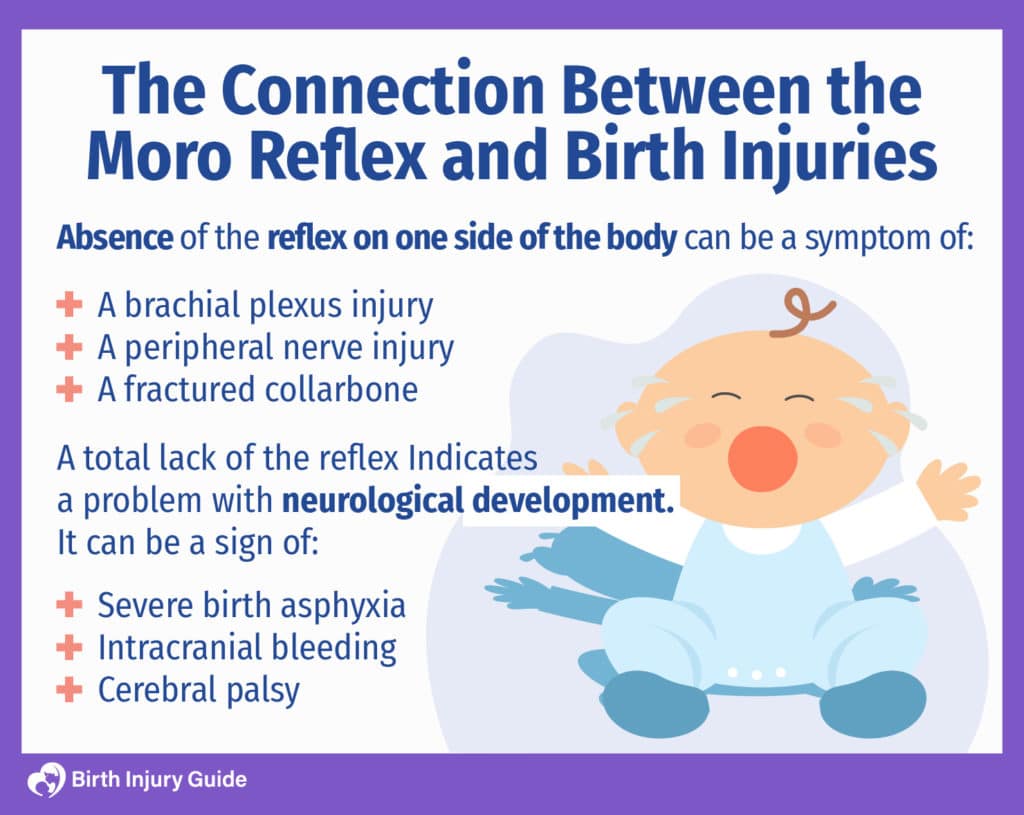 are-birth-asphyxia-and-moro-reflex-related-birth-injury-guide