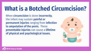 Botched Circumcision Caused By Negligence - Birth Injury Guide