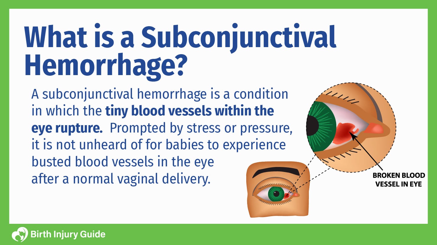 Fans: Duggar Baby Has Subconjunctival Hemorrhage?